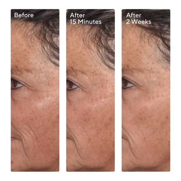 💄Targeted Wrinkle Corrector - Picture 3 of 4